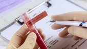 REZULTATI TESTA ZA 15 MINUTA: Nemci pronašli novi način za otkrivanje virusa korona REZULTATI TESTA ZA 15 MINUTA: Nemci pronašli novi način za otkrivanje virusa korona