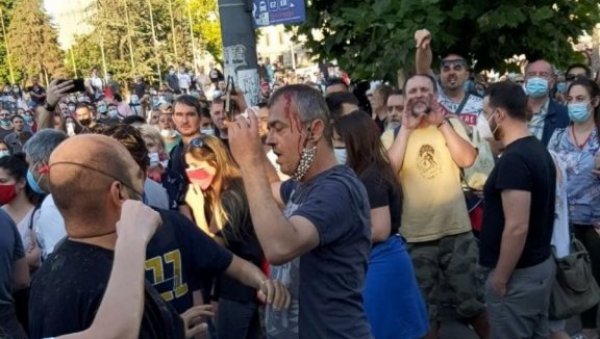 Насилни демонстранти напали Сергеја Трифуновића и разбили му главу (ФОТО) Насилни демонстранти напали Сергеја Трифуновића и разбили му главу (ФОТО)