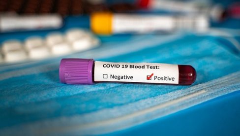 KORONA U SREDNJEM BANATU: Od 19 testiranih, sedam pozitivno na KOVID 19 KORONA U SREDNJEM BANATU: Od 19 testiranih, sedam pozitivno na KOVID 19