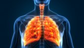 JAPANSKI LEKARI PRVI U SVETU: Prva transplantacija pluća bivšem kovid pacijentu JAPANSKI LEKARI PRVI U SVETU: Prva transplantacija pluća bivšem kovid pacijentu