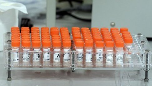 РЕЗУЛТАТИ ЗА 24 САТА: Довољно тестова и реагенаса у Ватреном оку РЕЗУЛТАТИ ЗА 24 САТА: Довољно тестова и реагенаса у Ватреном оку