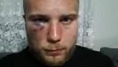 ИСПРЕБИЈАЛИ СРБИНА У ЦРНОЈ ГОРИ: Са два аутомобила су му блокирали пут, псовали му српску мајку и тукли ИСПРЕБИЈАЛИ СРБИНА У ЦРНОЈ ГОРИ: Са два аутомобила су му блокирали пут, псовали му српску мајку и тукли