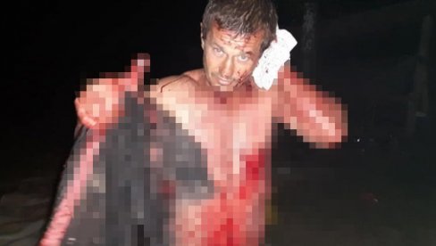 (УЗНЕМИРУЈУЋИ ФОТО) МИГРАНТИ ПРЕТУКЛИ МЕШТАНИНА ГЛИНИЦЕ: Помогнеш им, они овако враћају! (УЗНЕМИРУЈУЋИ ФОТО) МИГРАНТИ ПРЕТУКЛИ МЕШТАНИНА ГЛИНИЦЕ: Помогнеш им, они овако враћају!