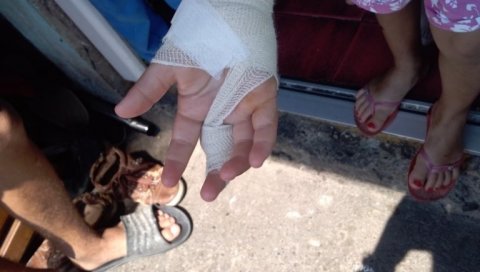 УЖАС У КРУШЕВЦУ! ДЕЧАК ЗАДОБИО ПОВРЕДЕ ГЛАВЕ: Његовој сестри рука завијена након активирања експлозивне направе УЖАС У КРУШЕВЦУ! ДЕЧАК ЗАДОБИО ПОВРЕДЕ ГЛАВЕ: Његовој сестри рука завијена након активирања експлозивне направе