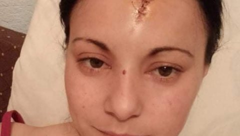 ПРЕТУЧЕНА ЖЕНА ИСПРЕД ПОРОДИЧНЕ КУЋЕ: Јелена се ноћу враћала из друге смене, а онда наишли хулигани (ФОТО) ПРЕТУЧЕНА ЖЕНА ИСПРЕД ПОРОДИЧНЕ КУЋЕ: Јелена се ноћу враћала из друге смене, а онда наишли хулигани (ФОТО)