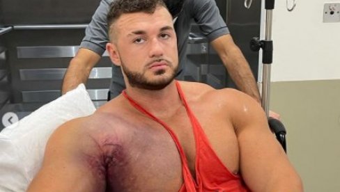 (UZNEMIRUJUĆI FOTO I VIDEO) BODIBILDER DOŽIVEO UŽASNU POVREDU: Pokidao mišić do same kosti (UZNEMIRUJUĆI FOTO I VIDEO) BODIBILDER DOŽIVEO UŽASNU POVREDU: Pokidao mišić do same kosti