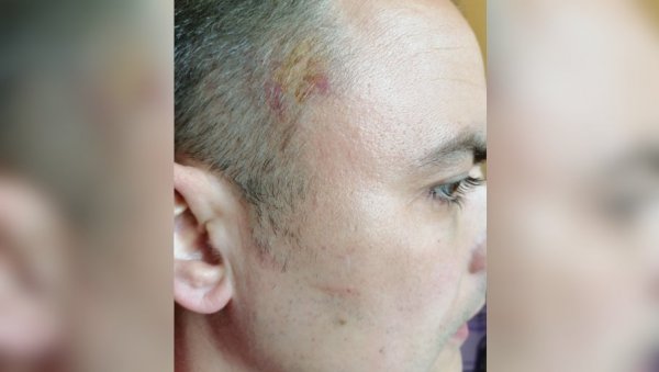 ДА СЕ СТАНЕ НА ПУТ НАПАДАЧУ ЛОГВИНОВУ: Градски одбор СНС осудио напад на Петра Јанковића (ФОТО) ДА СЕ СТАНЕ НА ПУТ НАПАДАЧУ ЛОГВИНОВУ: Градски одбор СНС осудио напад на Петра Јанковића (ФОТО)