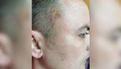 ДА СЕ СТАНЕ НА ПУТ НАПАДАЧУ ЛОГВИНОВУ: Градски одбор СНС осудио напад на Петра Јанковића (ФОТО)