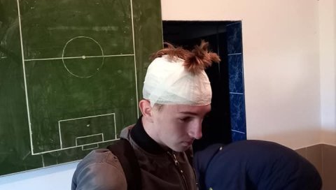 УЗНЕМИРУЈУЋЕ СЦЕНЕ: Шеснаестогодишњи фудбалер погођен флашом у главу у току меча (ФОТО) УЗНЕМИРУЈУЋЕ СЦЕНЕ: Шеснаестогодишњи фудбалер погођен флашом у главу у току меча (ФОТО)
