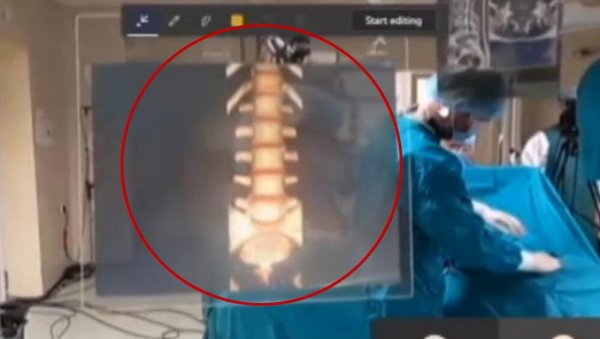 СРПСКИ ХИРУРЗИ ОПЕРИСАЛИ ПОМОЋУ ХОЛОГРАМА: Револуционарна технологија први пут употребљена у Београду - помаже и против короне СРПСКИ ХИРУРЗИ ОПЕРИСАЛИ ПОМОЋУ ХОЛОГРАМА: Револуционарна технологија први пут употребљена у Београду - помаже и против короне