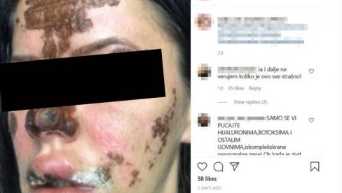(UZNEMIRUJUĆE) BEOGRAĐANKE UNAKAŽENE U SALONU LEPOTE: One tvrde su bile žrtve doktorke Olgice (FOTO) (UZNEMIRUJUĆE) BEOGRAĐANKE UNAKAŽENE U SALONU LEPOTE: One tvrde su bile žrtve doktorke Olgice (FOTO)