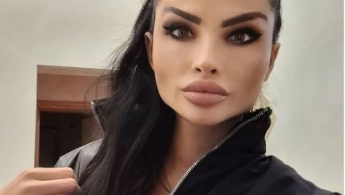 DANAS POČINJE SUĐENJE OLGICI MARKANOVIĆ: Nadrilekarka optužena da je vršila zahvate na pacijentima bez dozvole DANAS POČINJE SUĐENJE OLGICI MARKANOVIĆ: Nadrilekarka optužena da je vršila zahvate na pacijentima bez dozvole