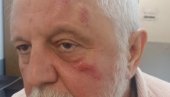 ГАГА АНОНИЈЕВИЋ ЗА НОВОСТИ: Бјелогрлић ме је дивљачки напао ГАГА АНОНИЈЕВИЋ ЗА НОВОСТИ: Бјелогрлић ме је дивљачки напао