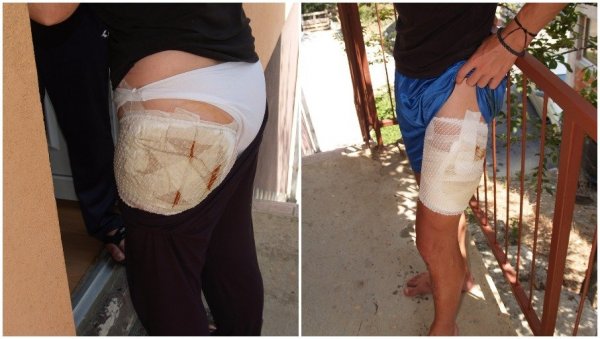 ПАС ИЗГРИЗАО ДЕТЕ И ЖЕНУ: Нови напад љубимца у Бањалуци отворио питање кажњавања неодговорних власника ПАС ИЗГРИЗАО ДЕТЕ И ЖЕНУ: Нови напад љубимца у Бањалуци отворио питање кажњавања неодговорних власника