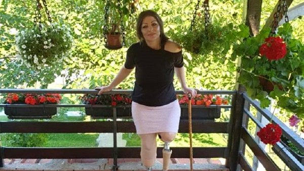 ЗБОГ НАТО БОМБИ ОСТАЛА БЕЗ НОГУ: Још само четири дана наде за Весну, треба јој помоћ за протезе ЗБОГ НАТО БОМБИ ОСТАЛА БЕЗ НОГУ: Још само четири дана наде за Весну, треба јој помоћ за протезе
