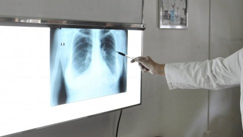 VELIKI KAŠALJ KOSI BEOGRAĐANE: Dr Begović Lazarević otkrila ko ga najviše prenosi i gde je izvor zaraze VELIKI KAŠALJ KOSI BEOGRAĐANE: Dr Begović Lazarević otkrila ko ga najviše prenosi i gde je izvor zaraze