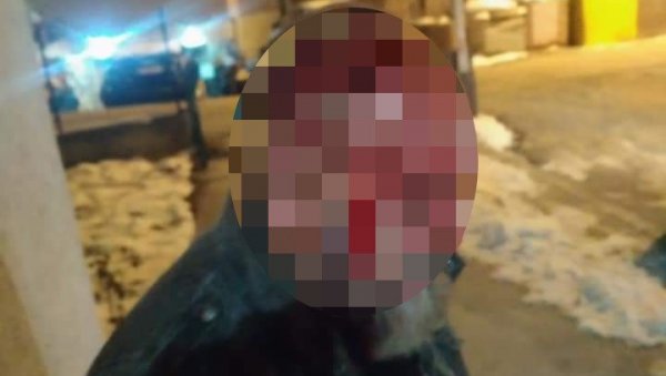 ТАНДЕМ ПРЕТУКАО ИСАДА МУРАТОВИЋА: Полиција расветлила пребијање члана Општинског одбора Демократа у Петњици ТАНДЕМ ПРЕТУКАО ИСАДА МУРАТОВИЋА: Полиција расветлила пребијање члана Општинског одбора Демократа у Петњици