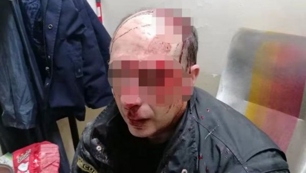 ХАПШЕЊЕ У БОРУ: Пали осумњичени због напада на радника обезбеђења ХАПШЕЊЕ У БОРУ: Пали осумњичени због напада на радника обезбеђења