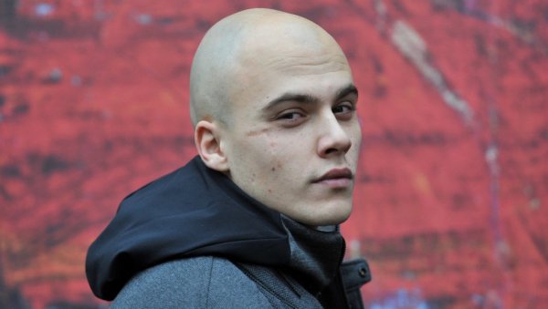 ОВО ЈЕ ИСТИНА О ОЖИЉКУ НА ЛИЦУ МИОДРАГА ДРАГИЧЕВИЋА Уследиле су операције и на крају ми је остао заштитни знак ОВО ЈЕ ИСТИНА О ОЖИЉКУ НА ЛИЦУ МИОДРАГА ДРАГИЧЕВИЋА Уследиле су операције и на крају ми је остао заштитни знак