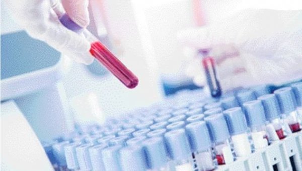 ВИРУС СЕ ШИРИ ЕВРОПОМ: У Швајцарској откривен први случај мајмунских богиња ВИРУС СЕ ШИРИ ЕВРОПОМ: У Швајцарској откривен први случај мајмунских богиња