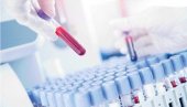 ВИРУС СЕ ШИРИ ЕВРОПОМ: У Швајцарској откривен први случај мајмунских богиња ВИРУС СЕ ШИРИ ЕВРОПОМ: У Швајцарској откривен први случај мајмунских богиња