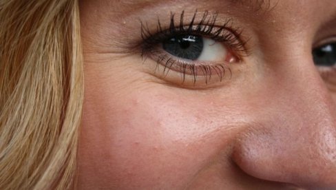KAD OKO IGRA: Zbog kontrakcija mišića na licu i kod neurologa KAD OKO IGRA: Zbog kontrakcija mišića na licu i kod neurologa