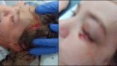 ДЕВОЈЧИЦА КОЈУ ЈЕ ПОВРЕДИО ПИТ БУЛ ПРЕПЛАШЕНА: Власник пса негирао да је животиња његова - цео догађај снимиле сигурносне камере