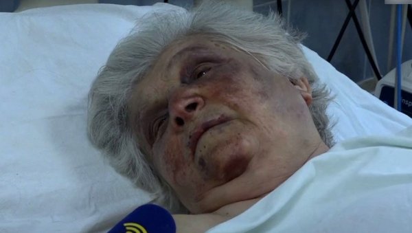 ЧУПАЛИ СУ МЕ И ГЛАВОМ МИ УДАРАЛИ О ПОД: Бака Божана из Северне Митровице у болници након стравичног напада (ВИДЕО) ЧУПАЛИ СУ МЕ И ГЛАВОМ МИ УДАРАЛИ О ПОД: Бака Божана из Северне Митровице у болници након стравичног напада (ВИДЕО)