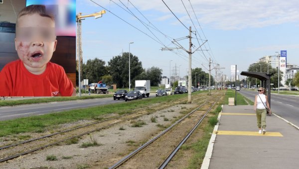 ИТАН ЈЕ ВИШЕ УПЛАШЕН НЕГО ШТО ЈЕ ПОВРЕЂЕН: Беби лакше повређена десна страна лица, урађен рендген и УЗ ИТАН ЈЕ ВИШЕ УПЛАШЕН НЕГО ШТО ЈЕ ПОВРЕЂЕН: Беби лакше повређена десна страна лица, урађен рендген и УЗ