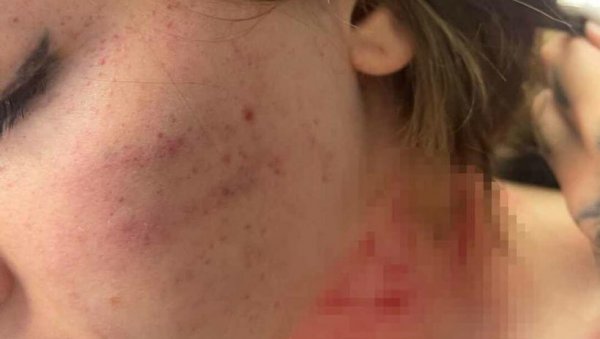 ОДРЕЂЕН ПРИТВОР МУЖУ ПРЕТУЧЕНЕ СЕСТРЕ ТИКТОКЕРКЕ: Сумња се да би боравком на слободи утицао на истрагу ОДРЕЂЕН ПРИТВОР МУЖУ ПРЕТУЧЕНЕ СЕСТРЕ ТИКТОКЕРКЕ: Сумња се да би боравком на слободи утицао на истрагу