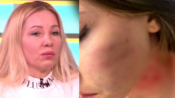 БИЛА ЈЕ ИЗДЕФОРМИСАНА, МОЛИЛА МЕ ДА ЈОЈ ЧУВАМ БЕБУ: Потресне речи мајке претучене Саре, расплакала се у студију док је говорила о насиљу БИЛА ЈЕ ИЗДЕФОРМИСАНА, МОЛИЛА МЕ ДА ЈОЈ ЧУВАМ БЕБУ: Потресне речи мајке претучене Саре, расплакала се у студију док је говорила о насиљу