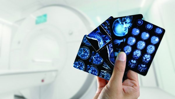 ОВО ЈЕ РАК КОЈИ СЕ НАЈТЕЖЕ ПРЕПОЗНА: 20 година треба да покаже симтоме, али 1 сигнал не греши ОВО ЈЕ РАК КОЈИ СЕ НАЈТЕЖЕ ПРЕПОЗНА: 20 година треба да покаже симтоме, али 1 сигнал не греши