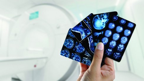 OVO JE RAK KOJI SE NAJTEŽE PREPOZNA: 20 godina treba da pokaže simtome, ali 1 signal ne greši OVO JE RAK KOJI SE NAJTEŽE PREPOZNA: 20 godina treba da pokaže simtome, ali 1 signal ne greši