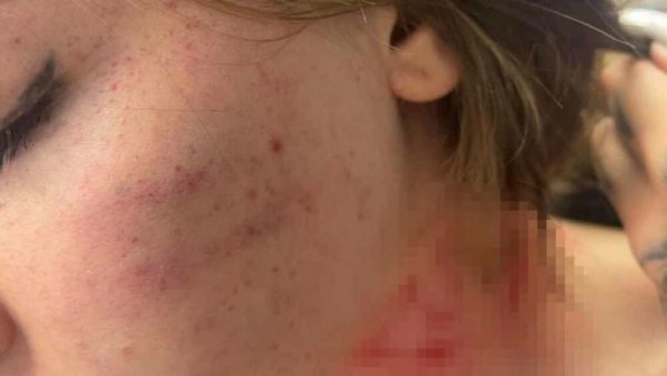 ПОЧИЊЕ СУЂЕЊЕ ЗБОГ НАСИЉА НАД СЕСТРОМ ТИКТОКЕРКЕ УКИ КЈУ: Дамјан Х.(25) претукао жену и зарадио оптужницу ПОЧИЊЕ СУЂЕЊЕ ЗБОГ НАСИЉА НАД СЕСТРОМ ТИКТОКЕРКЕ УКИ КЈУ: Дамјан Х.(25) претукао жену и зарадио оптужницу