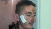 КРИВИЧНЕ ПРИЈАВЕ У ШАВНИКУ: Познат идентитет осумњичених за напад на одборника (ФОТО) КРИВИЧНЕ ПРИЈАВЕ У ШАВНИКУ: Познат идентитет осумњичених за напад на одборника (ФОТО)