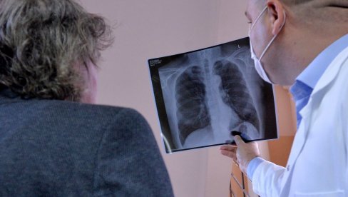 RAK PLUĆA SVAKOG DANA ODNESE 13 ŽIVOTA: Srbija prva na Zapadnom Balkanu uvodi program ranog otkrivanja jednog od najprogresivnijih karcinoma RAK PLUĆA SVAKOG DANA ODNESE 13 ŽIVOTA: Srbija prva na Zapadnom Balkanu uvodi program ranog otkrivanja jednog od najprogresivnijih karcinoma