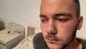 ОТАЦ ПРЕТУЧЕНОГ СРПСКОГ МЛАДИЋА ЗА НОВОСТИ: Напали су моје дете из чиста мира - целу ноћ су га држали у полицији