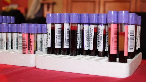 АКЦИЈА ДОБРОВОЉНОГ ДАВАЊА КРВИ: Позив на хуман гест АКЦИЈА ДОБРОВОЉНОГ ДАВАЊА КРВИ: Позив на хуман гест