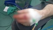 УЗНЕМИРУЈУЋЕ Фотографије рањеног Србина на ког су пуцали Куртијеви специјалци (ФОТО) УЗНЕМИРУЈУЋЕ Фотографије рањеног Србина на ког су пуцали Куртијеви специјалци (ФОТО)