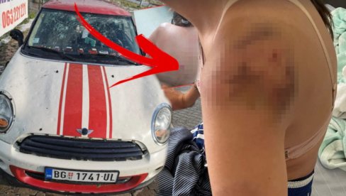 IZUBIJANA I SVA U MASNICAMA: Doktor joj nije verovao da su povrede od grada - Ivana objavila slike nakon superćelijske oluje (FOTO) IZUBIJANA I SVA U MASNICAMA: Doktor joj nije verovao da su povrede od grada - Ivana objavila slike nakon superćelijske oluje (FOTO)