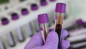OD ANEMIJE, DO BOLESTI JETRE: Šta visok i nizak nivo hemoglobina otkrivaju o zdravlju OD ANEMIJE, DO BOLESTI JETRE: Šta visok i nizak nivo hemoglobina otkrivaju o zdravlju