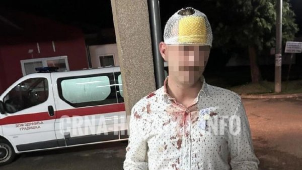 СТЕФАН РАЗБИО ГЛАВУ ЗБОГ ШЕМСИНЕ ПЕСМЕ: Има отворене ране, а налаз докторке је хит на мрежама (ФОТО) СТЕФАН РАЗБИО ГЛАВУ ЗБОГ ШЕМСИНЕ ПЕСМЕ: Има отворене ране, а налаз докторке је хит на мрежама (ФОТО)