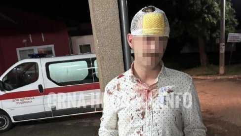 СТЕФАН РАЗБИО ГЛАВУ ЗБОГ ШЕМСИНЕ ПЕСМЕ: Има отворене ране, а налаз докторке је хит на мрежама (ФОТО) СТЕФАН РАЗБИО ГЛАВУ ЗБОГ ШЕМСИНЕ ПЕСМЕ: Има отворене ране, а налаз докторке је хит на мрежама (ФОТО)