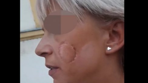 UHAPŠEN NASILNIK KOJI JE UJEO BIVŠU ŽENU: Povukao je za kosu, udario i stiskao glavu o zid zgrade bolnice u Sremskoj Mitrovici UHAPŠEN NASILNIK KOJI JE UJEO BIVŠU ŽENU: Povukao je za kosu, udario i stiskao glavu o zid zgrade bolnice u Sremskoj Mitrovici