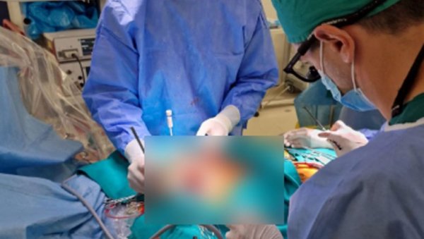 ОПЕРИСАНА ДЕВЕТОГОДИШЊА ДЕВОЈЧИЦА: Пао јој камен на главу са куће у Сињу ОПЕРИСАНА ДЕВЕТОГОДИШЊА ДЕВОЈЧИЦА: Пао јој камен на главу са куће у Сињу