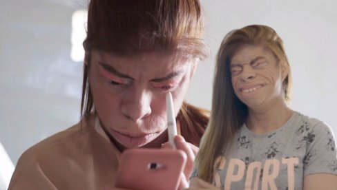 PERU RUKE KADA ME DOTAKNU Tiktokerku (23) zbog bolesti nazivaju ČUDOVIŠTEM (VIDEO) PERU RUKE KADA ME DOTAKNU Tiktokerku (23) zbog bolesti nazivaju ČUDOVIŠTEM (VIDEO)