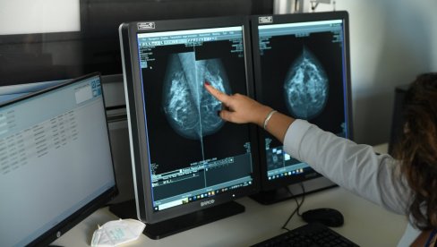 ZA ŽENE ULTRAZVUK DOJKE, A MUŠKARCIMA PSA TEST: Besplatni pregledi u nedelju, 10. decembra u Domu zdravlja na Limanu u Novom Sadu ZA ŽENE ULTRAZVUK DOJKE, A MUŠKARCIMA PSA TEST: Besplatni pregledi u nedelju, 10. decembra u Domu zdravlja na Limanu u Novom Sadu
