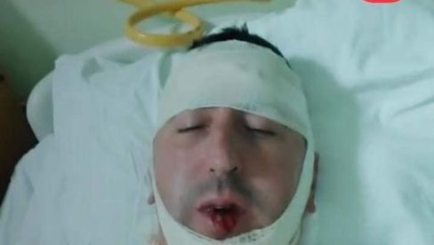UHAPŠEN JEDAN OD BATINAŠA: Posle napada na nikšićkog aktivistu Boška Pavićevića UHAPŠEN JEDAN OD BATINAŠA: Posle napada na nikšićkog aktivistu Boška Pavićevića