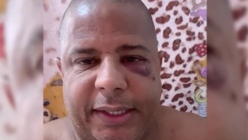 ČUVENI BRAZILAC BRUTALNO PRETUČEN! Bivši fudbaler izašao u provod sa udatom ženom, pa završio u modricama (VIDEO)