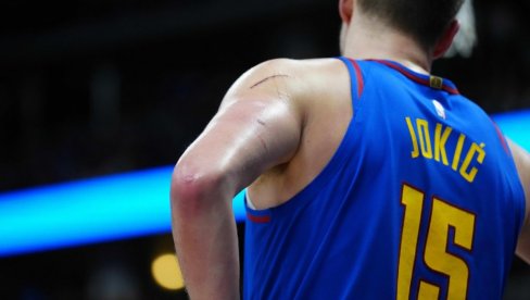 JOKIĆEVE RUKE IZGLEDAJU JEZIVO: Sav je u podlivima i ožiljcima! (VIDEO) JOKIĆEVE RUKE IZGLEDAJU JEZIVO: Sav je u podlivima i ožiljcima! (VIDEO)